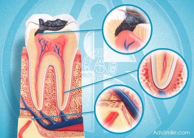 Toothache Treatment in Port St Lucie, FL
